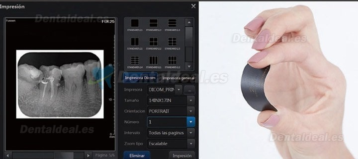 Fussen F200 Dental Phosphor Plate Scanner PSP X ray Scanner